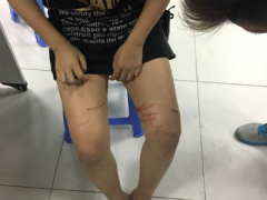 Ảnh bìa bài viết 415254