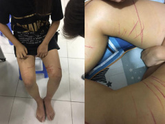 Ảnh bìa bài viết 415516