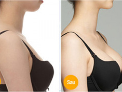 Ảnh bìa bài viết 424270