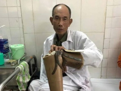 Ảnh bìa bài viết 427313