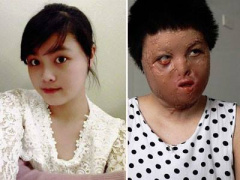 Ảnh bìa bài viết 428130