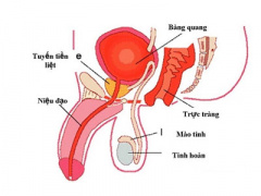 Ảnh bìa bài viết 429041
