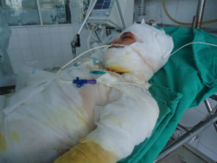 Ảnh bìa bài viết 433506