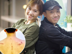 Ảnh bìa bài viết 434394