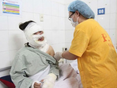 Ảnh bìa bài viết 434981