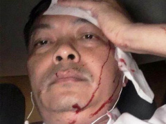 Ảnh bìa bài viết 435408