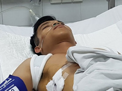 Ảnh bìa bài viết 436775