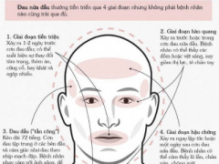 Ảnh bìa bài viết 438713