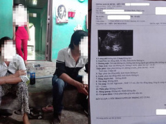 Ảnh bìa bài viết 442116