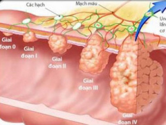 Ảnh bìa bài viết 446792