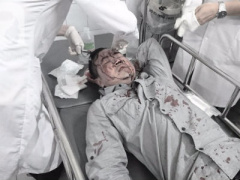 Ảnh bìa bài viết 448386