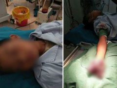 Ảnh bìa bài viết 449146