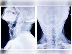 Ảnh bìa bài viết 449785