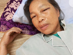 Ảnh bìa bài viết 452544