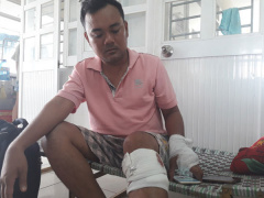 Ảnh bìa bài viết 452611