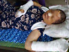 Ảnh bìa bài viết 453698