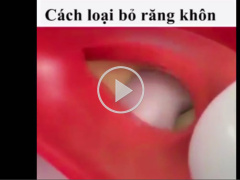 Ảnh bìa bài viết 453718