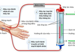 Ảnh bìa bài viết 456626