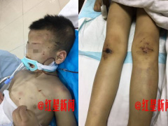 Ảnh bìa bài viết 461079