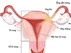 Ảnh bìa bài viết 462059