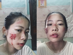 Ảnh bìa bài viết 462819