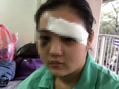 Ảnh bìa bài viết 463403