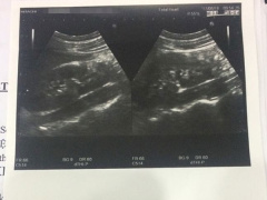 Post cover 463526