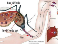 Ảnh bìa bài viết 464558