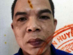 Ảnh bìa bài viết 465214