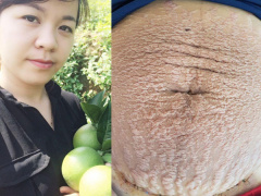 Ảnh bìa bài viết 467639