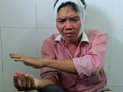 Ảnh bìa bài viết 467991