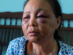 Ảnh bìa bài viết 469306