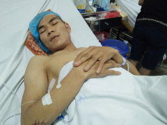 Ảnh bìa bài viết 469898