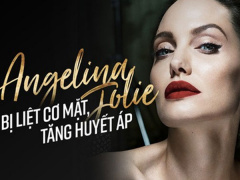 Ảnh bìa bài viết 470108
