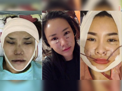 Ảnh bìa bài viết 470366