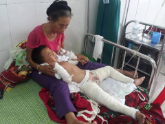 Ảnh bìa bài viết 470540