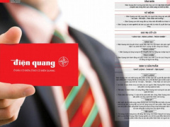Ảnh bìa bài viết 472173