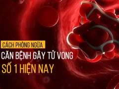 Ảnh bìa bài viết 473013