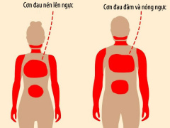 Ảnh bìa bài viết 475838