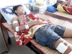 Ảnh bìa bài viết 475881