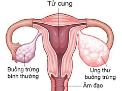 Ảnh bìa bài viết 477369