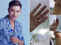 Ảnh bìa bài viết 478583