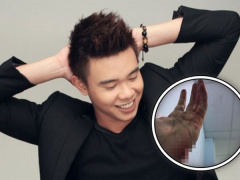 Ảnh bìa bài viết 478450