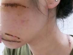Ảnh bìa bài viết 478721