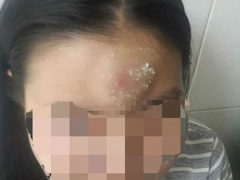 Ảnh bìa bài viết 480462