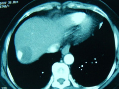 Ảnh bìa bài viết 483121