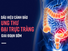 Ảnh bìa bài viết 486674