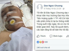 Ảnh bìa bài viết 488120