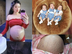 Ảnh bìa bài viết 489508