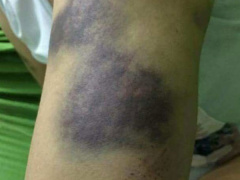 Post cover 489710
